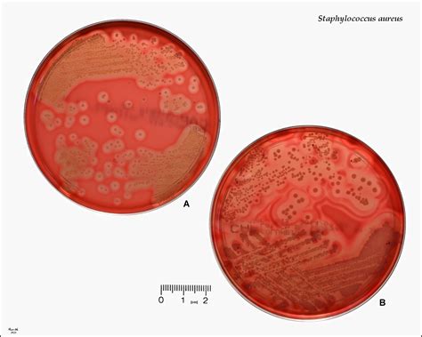 s aureus beta hemolytic|Staphylococcus aureus Colony Morphology and Key Characteristics.